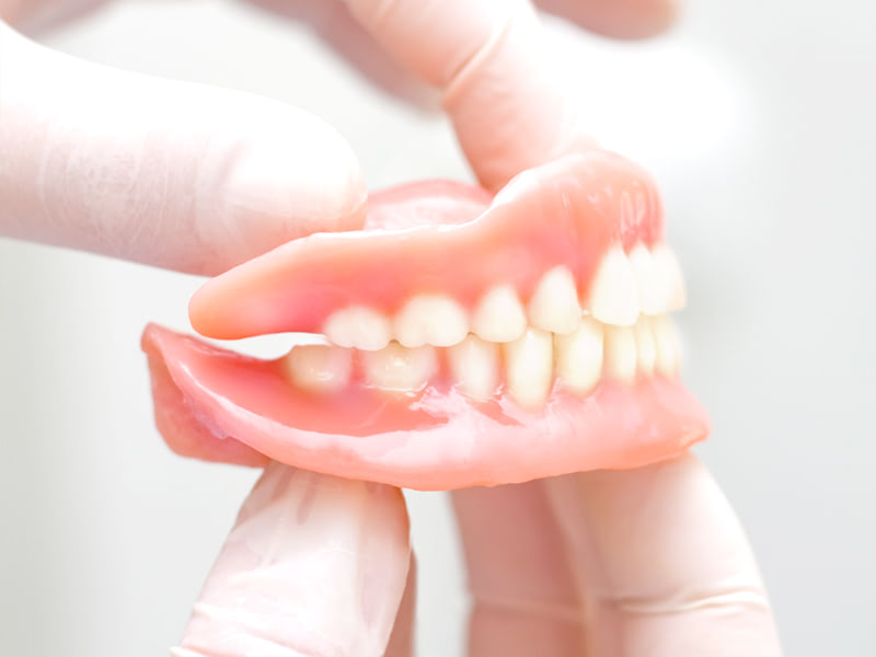 入れ歯（義歯）